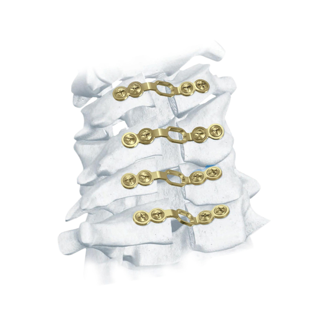 Sistema de laminoplastia cervical posterior