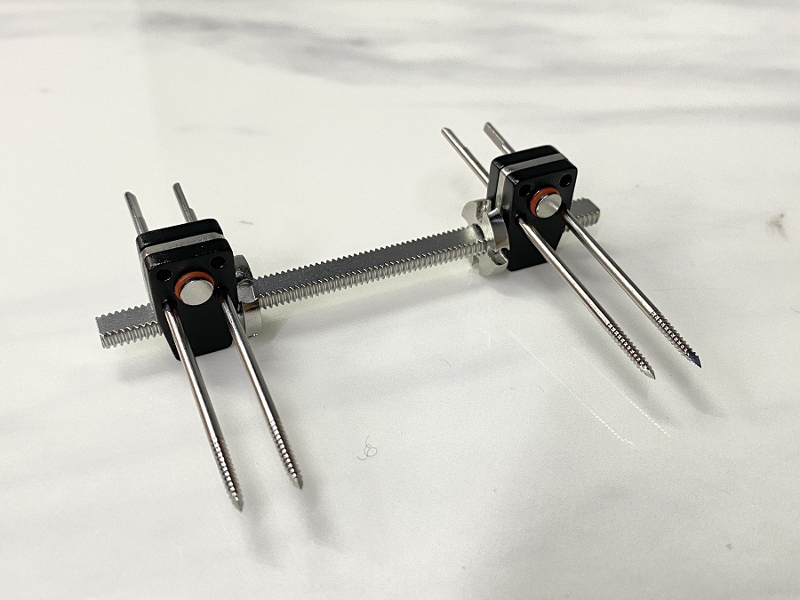 Fijador externo de mini fragmentos
