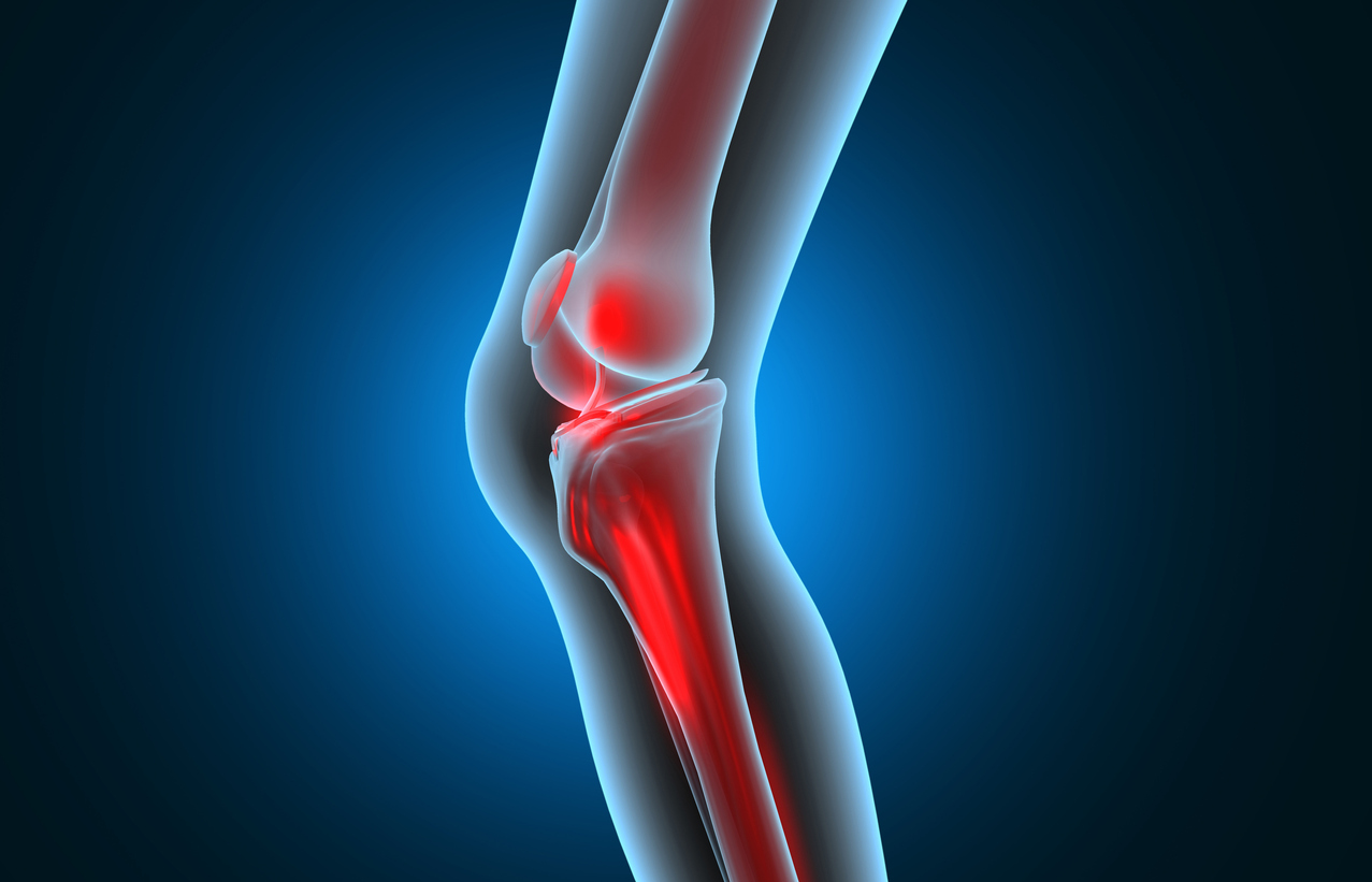 ¿Cómo usar la resonancia magnética para diagnosticar lesiones de ligamentos y meniscos de rodilla?