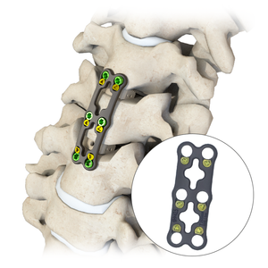 Sistema de fijación de la columna cervical anterior