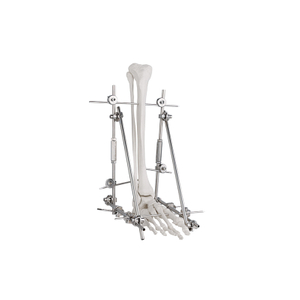 Junta de tobillo Fastador externo 9100-2401