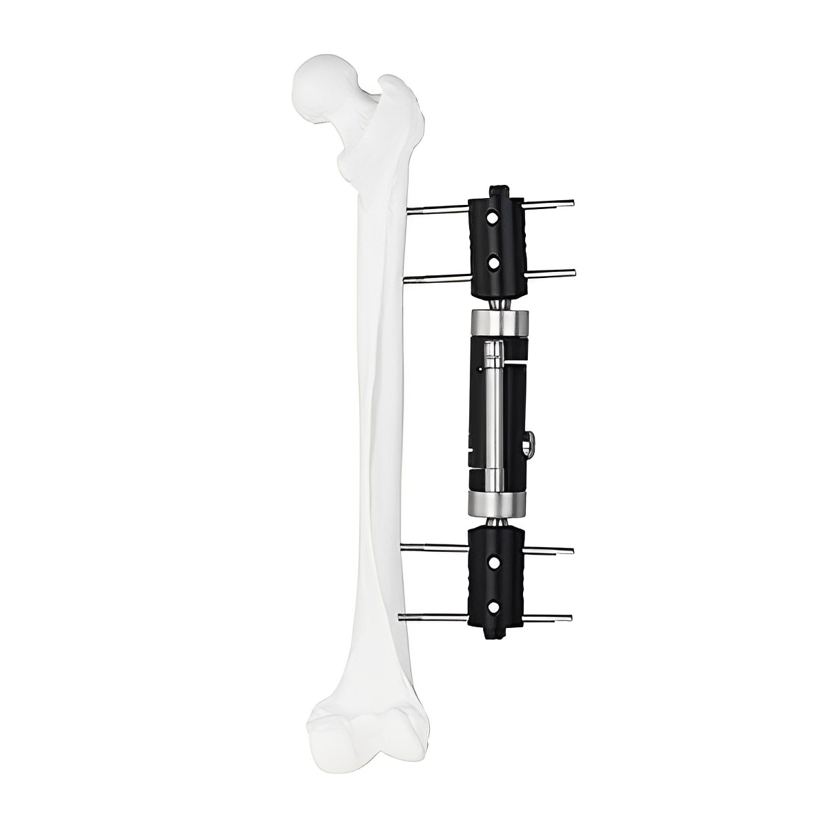 Fijador multiaxial dinámico