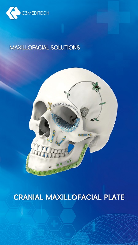 placa maxilofacial craneal