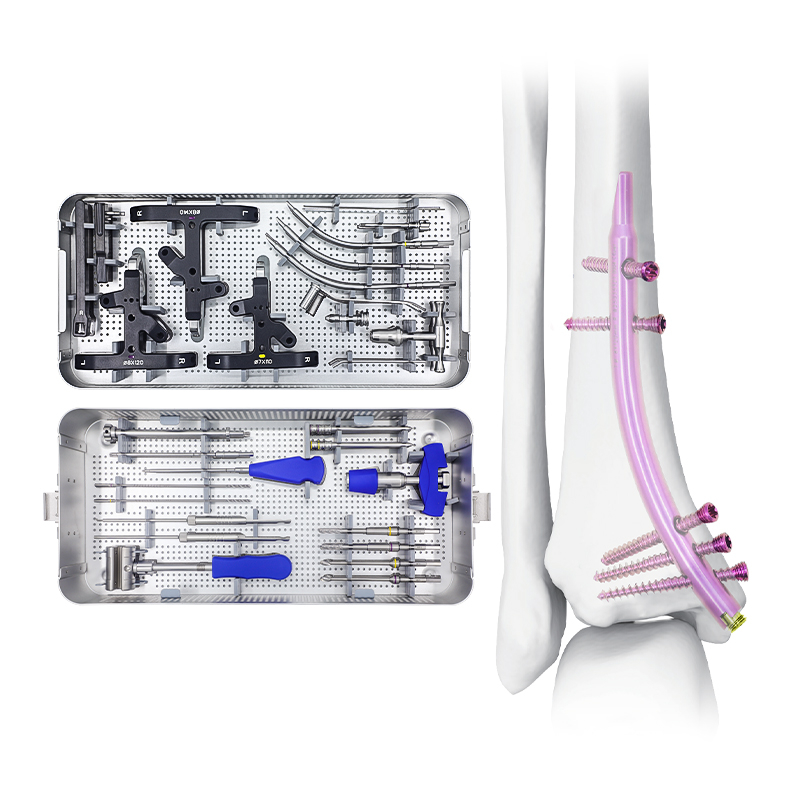 Conjunto de instrumentos de uñas intramedulares tibiales (DTN) distales