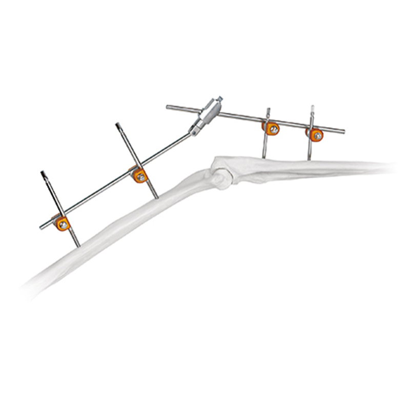 Articulación de la junta del codo Fastador externo