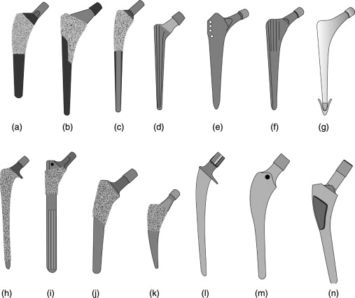 Types of femoral stem Tipos de vástago femoral