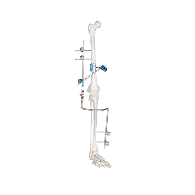 Articulación de la rodilla fijador externo