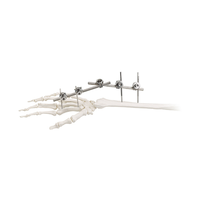 Junta de muñeca fijador externo 9100-1501