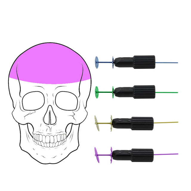 ALCACIÓN CRANIAL CLANCO DEL CÁLABLE
