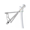 FNS (Sistema de cuello femoral)