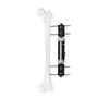 Fijador externo de tipo recto axial dinámico