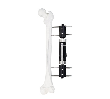 Fijador externo de tipo recto axial dinámico