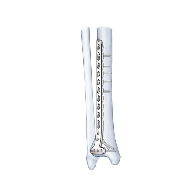 Placa de bloqueo tibial proximal medial