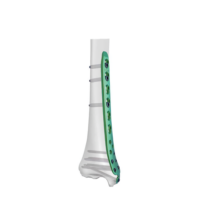 Placa de bloqueo tibial distal medial-I