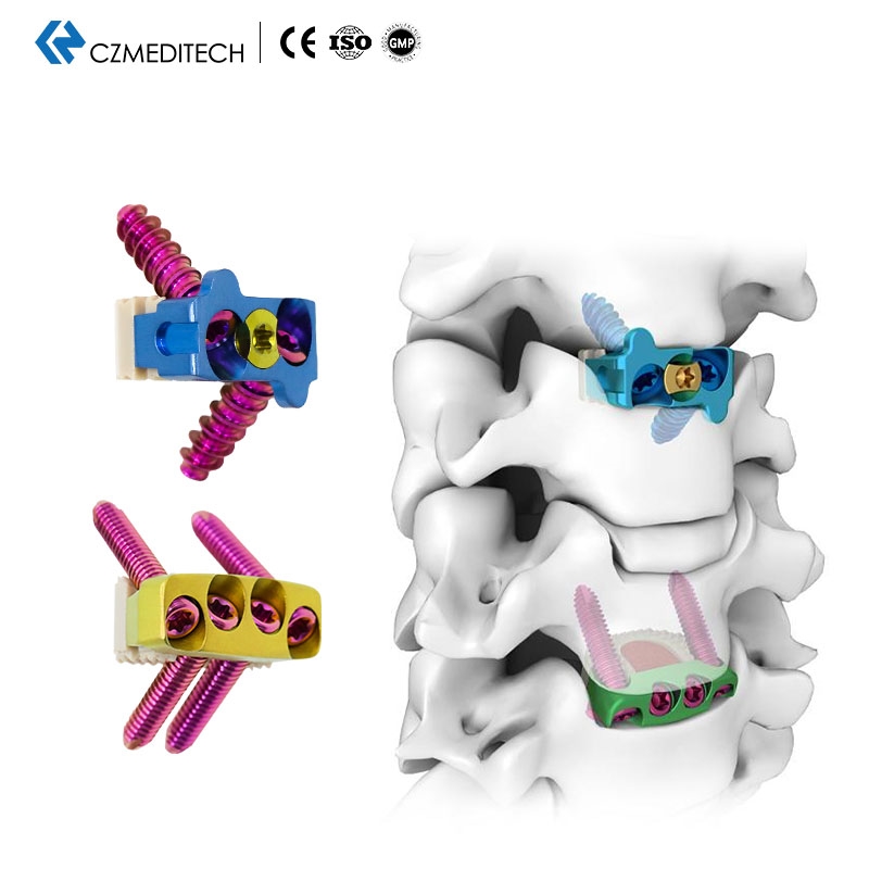 Jaula de mirada cervical （2 o 4 tornillos de bloqueo）