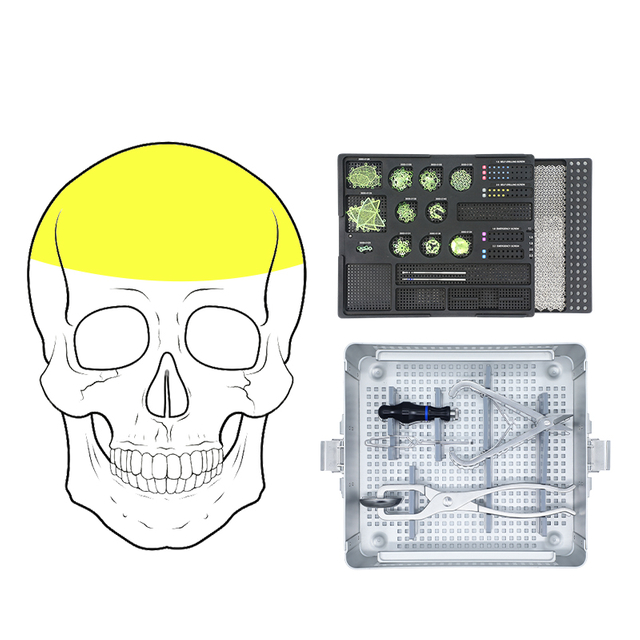 Sistema de restauración y reconstrucción de neurocirugía