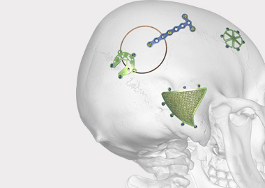 Sistema de revestimiento de neuro