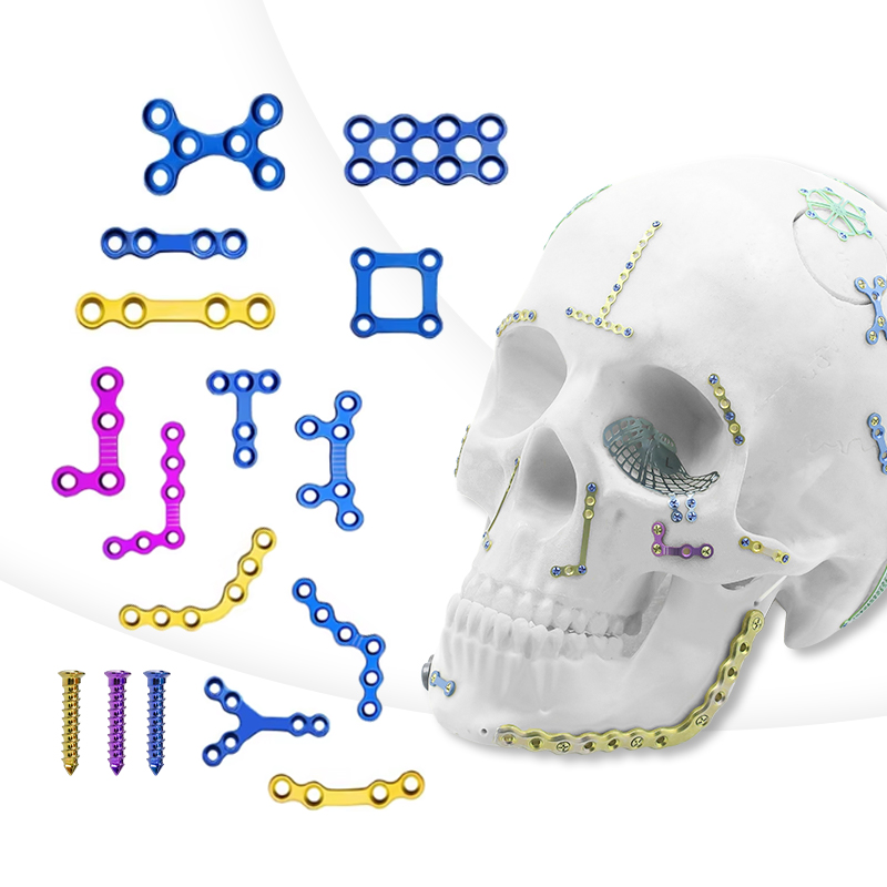 Sistema de placa maxilofacial de 1.5 mm
