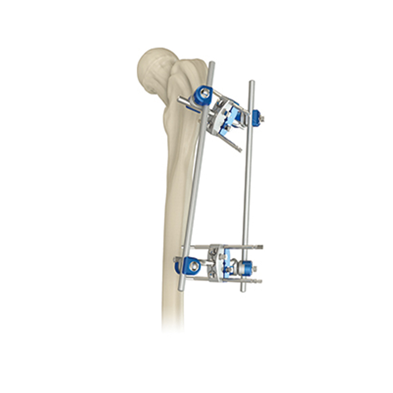 Fijador externo del fémur proximal