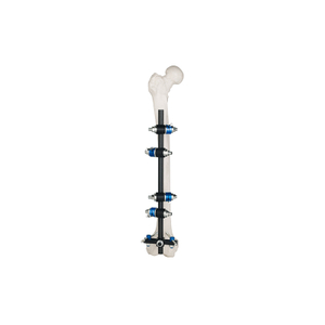 T Frame Fastador externo