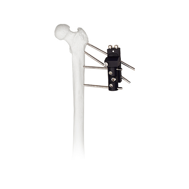 Fijador externo de tracción axial dinámica de la articulación de la cadera