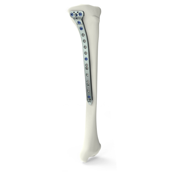 Placa de bloqueo para osteotomía tibial proximal medial