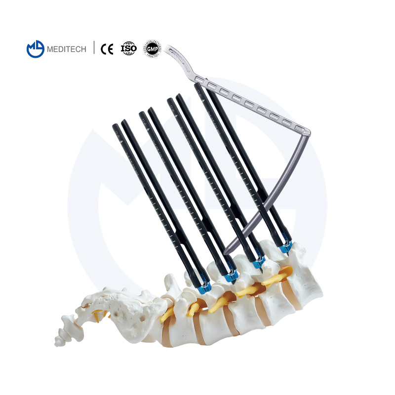 MIS Sistema de tornillo de pedículo espinal (sistema de 5.5 mm)
