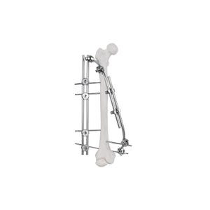 Eje femoral fijador externo 9100-2301