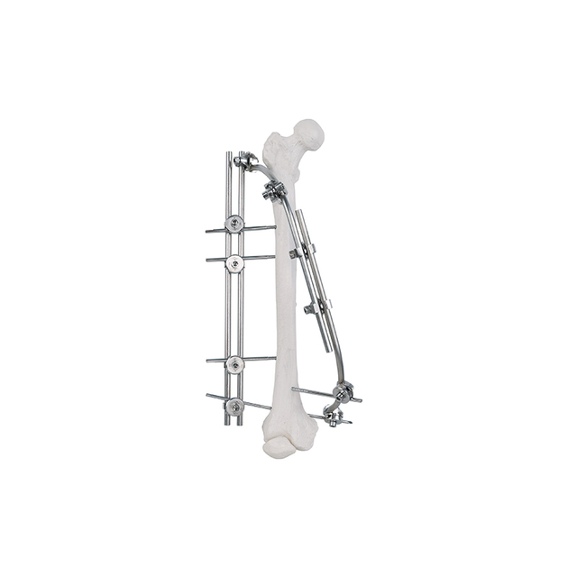 Eje femoral fijador externo 9100-2301