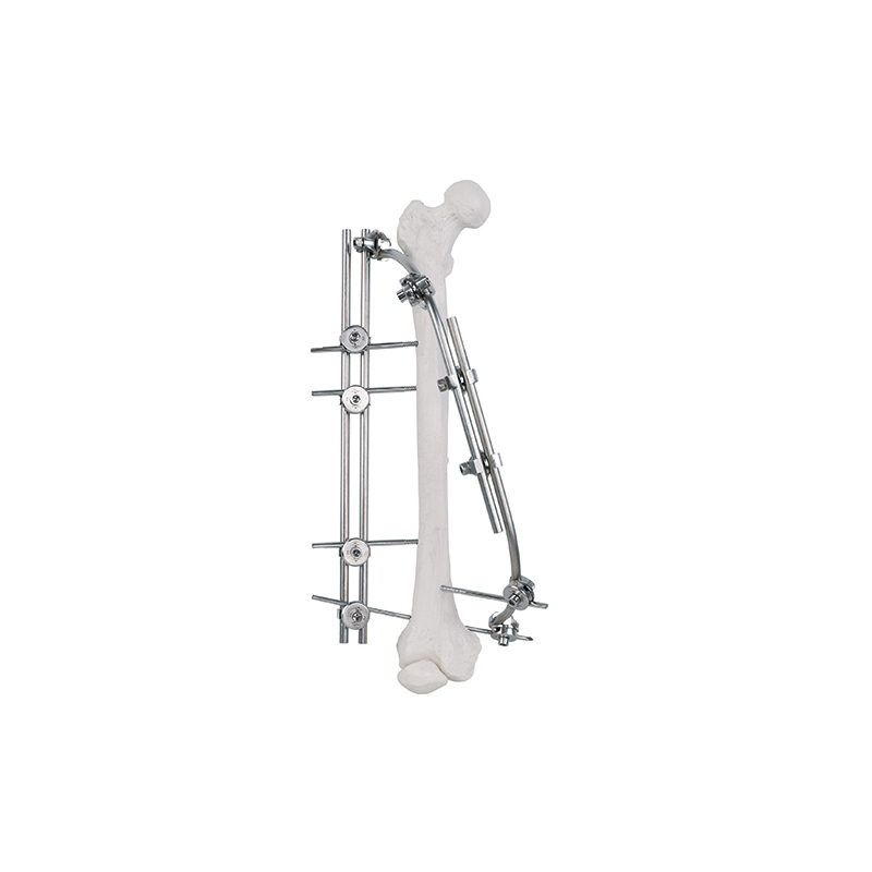 Eje femoral fijador externo 9100-2301
