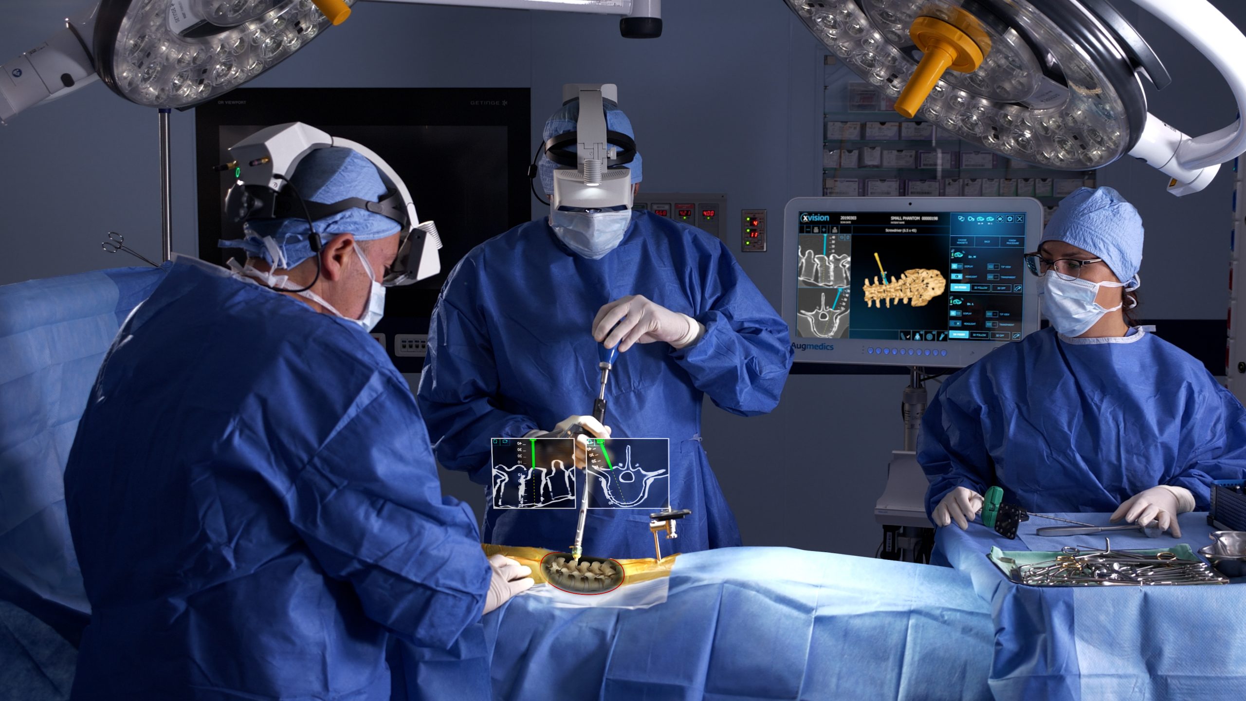 Procedimiento Quirúrgico para Implantes de Columna Vertebral