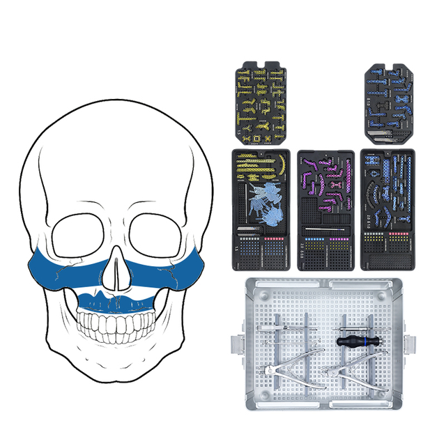 Sistema de placa maxilofacial de 2.0 mm