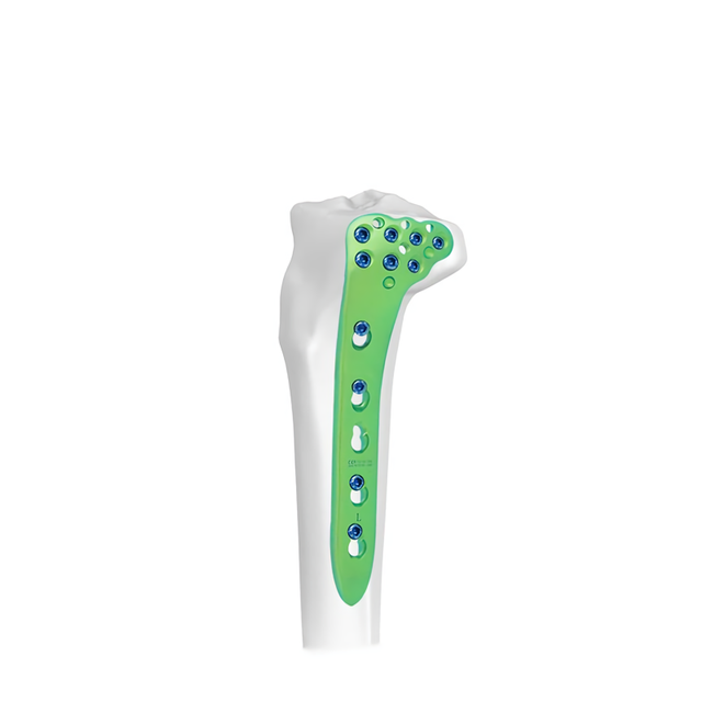 Placa de Bloqueo Tibial Proximal Lateral-I
