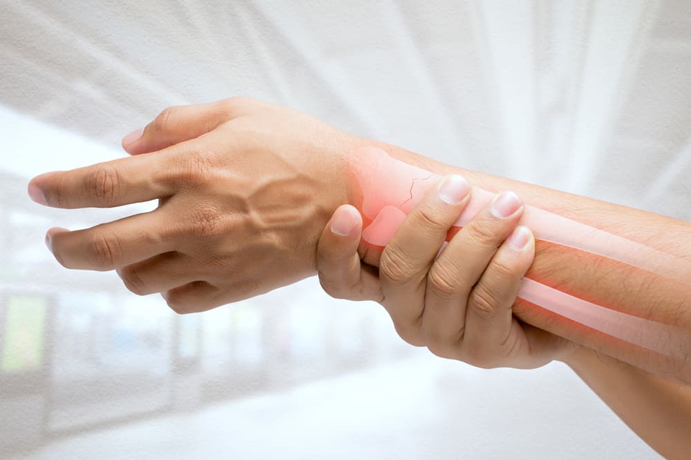¿Cómo tratar una fractura de radio distal de edad avanzada?