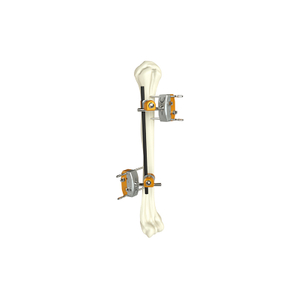 Humeral eje fijador externo
