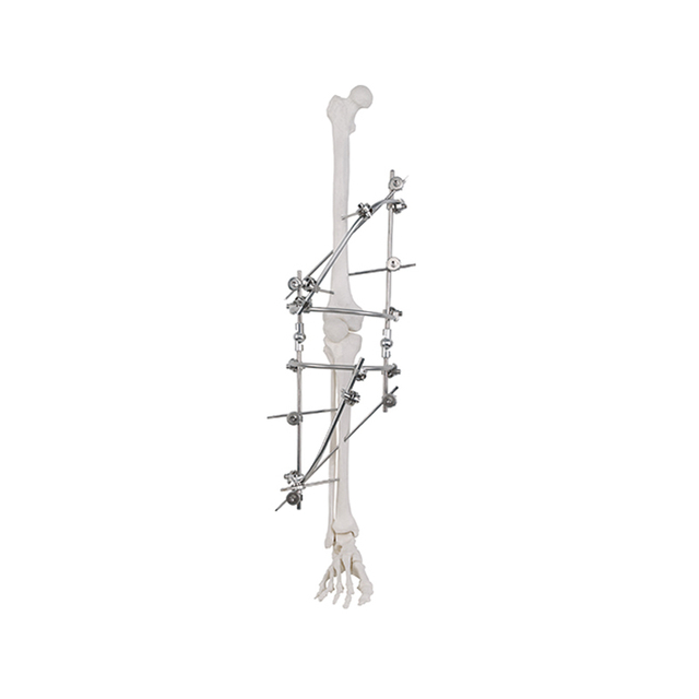 Junta de rodilla fijador externo 9100-2701