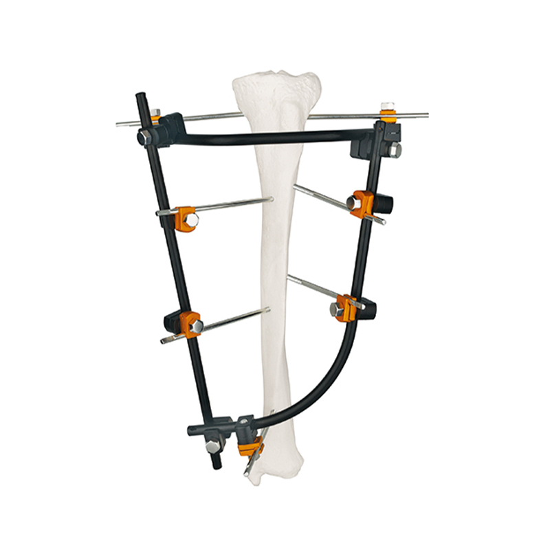 Lado de la junta tibial fijador externo