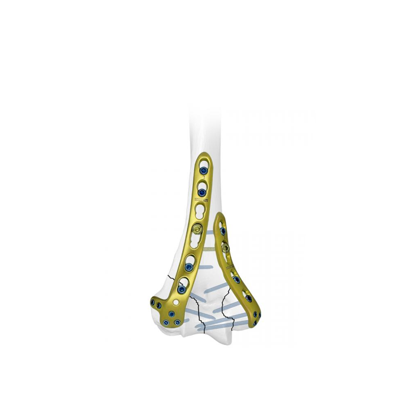 Placa de bloqueo humeral lateral distal