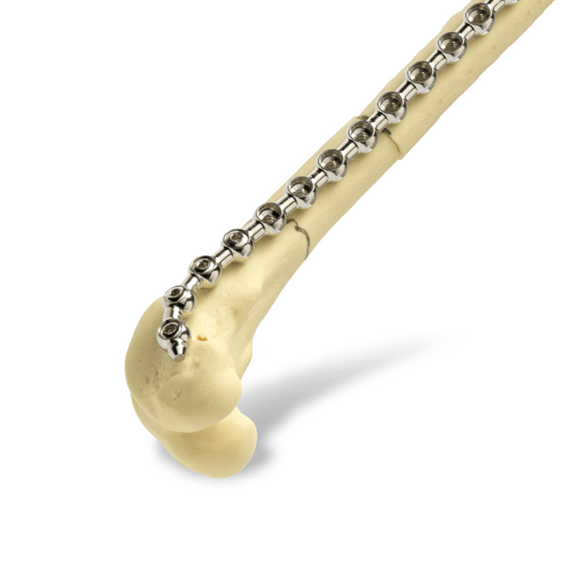 Collar de perlas (SOP)