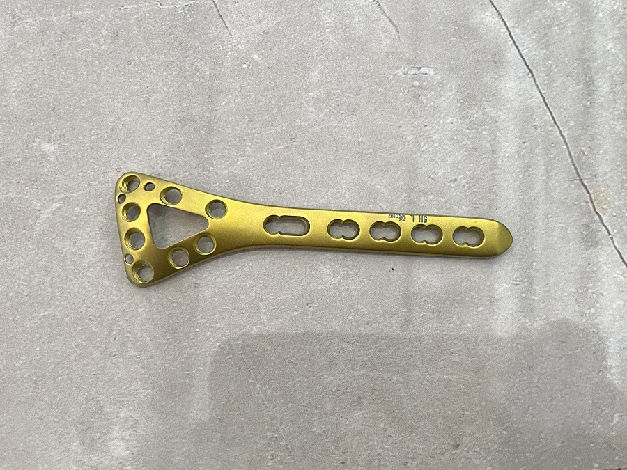 Placa de bloqueo delta radial dorsal distal
