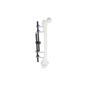 Tipo recto Fastador externo 8100-10