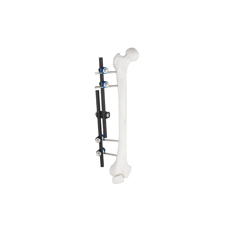 Tipo recto Fastador externo 8100-10