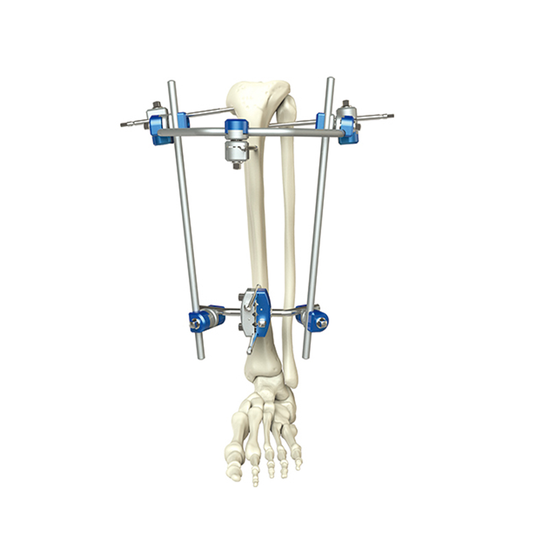 Tibia proximal fijador externo