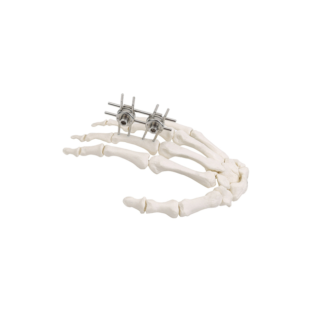 Mini-Expinatador EXTERNAL (Finger & Palm)