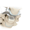 Jaula Cervical Peek-II