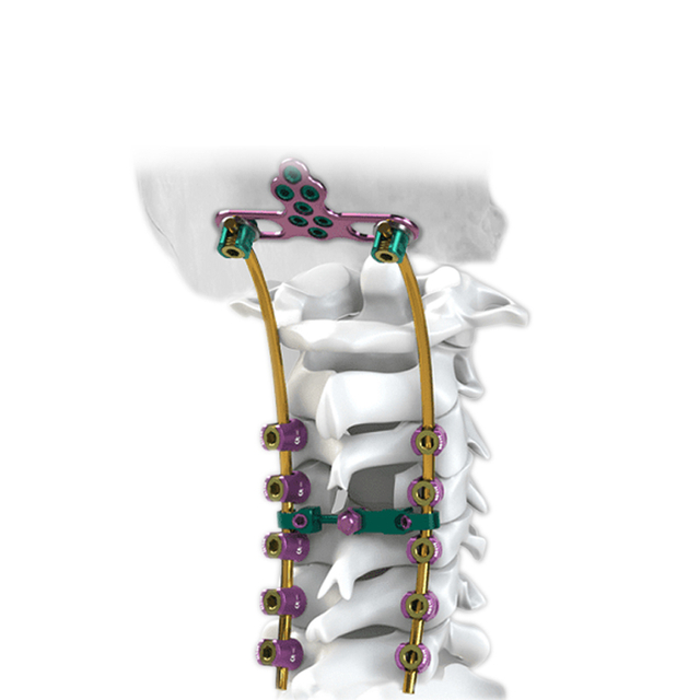 Sistema de tornillo cervical posterior