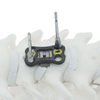 Placa cervical anterior NovaFix-I