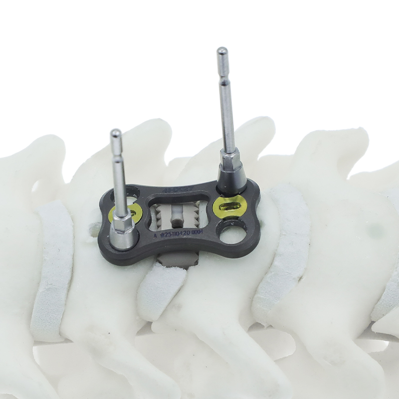 Placa cervical anterior NovaFix-I