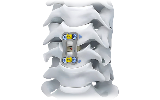 Placa cervical anterior NovaFix-I