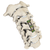 Placa cervical anterior ARIES-III